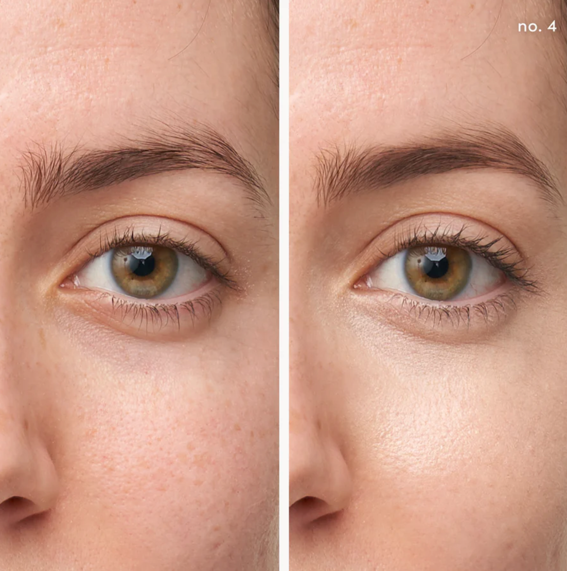 Active Light® Under-eye Concealer