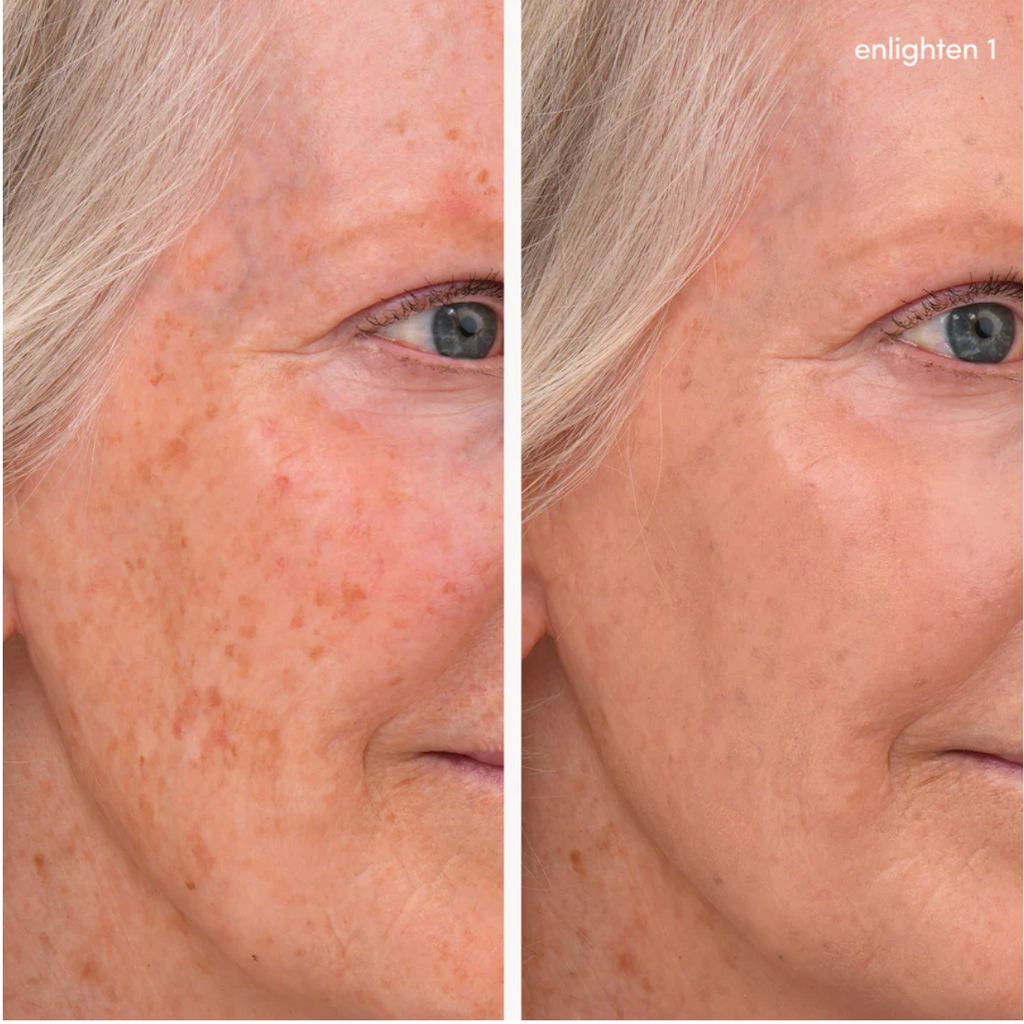 Enlighten Concealer