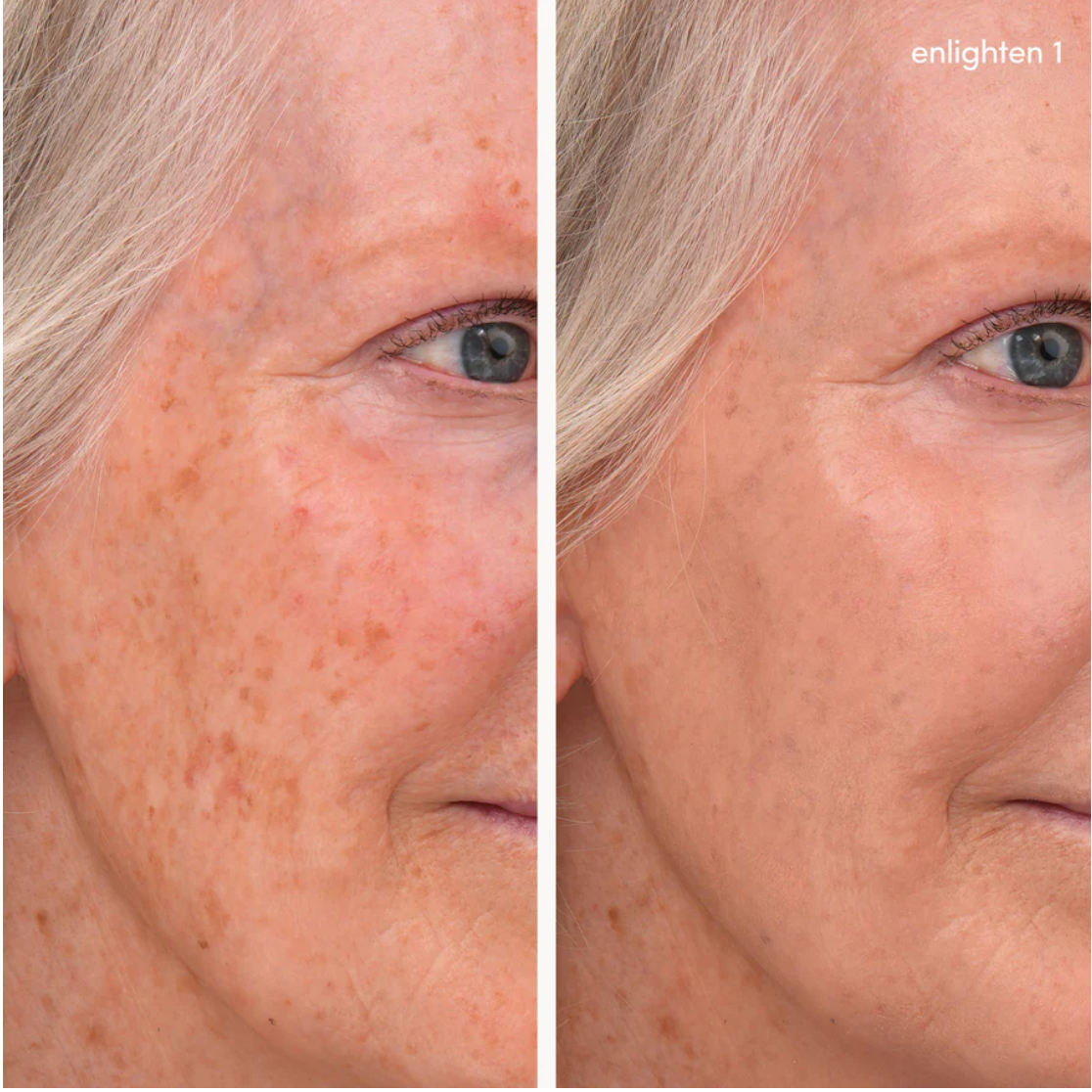 Enlighten Concealer